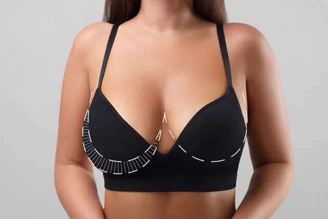 Breast reduction in Fort Lauderdale and Plantation, FL