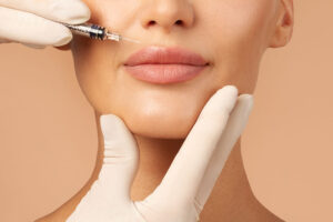 Perlane treatment
