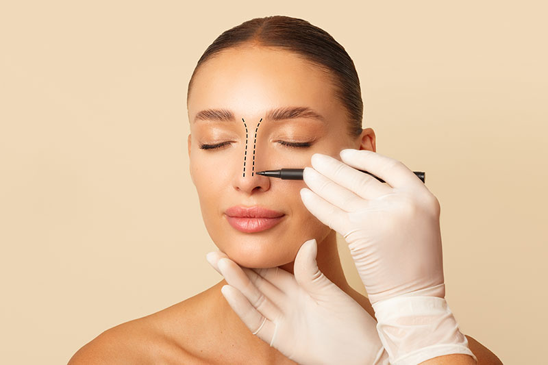 Rhinoplasty in Fort Lauderdale and Plantation, FL