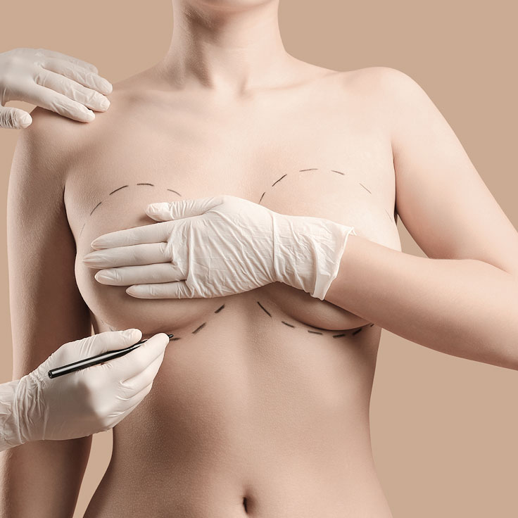 breast treatments